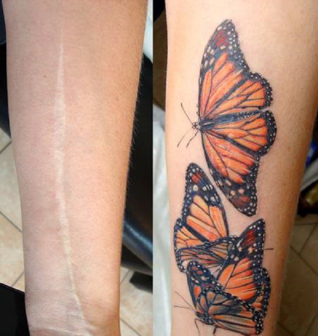 Татуировки закрывающие шрамы