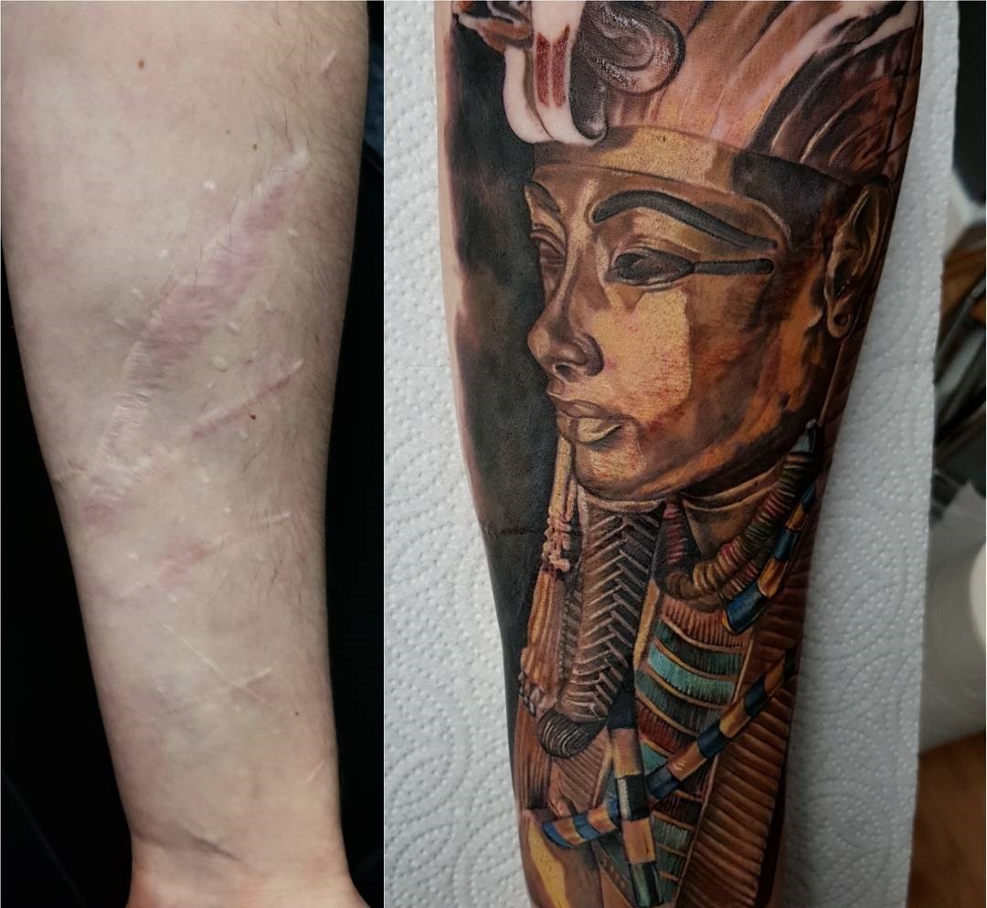 татуировки на руке мужские на шраме