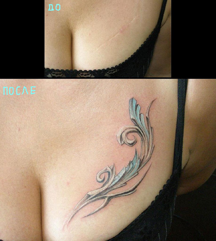 Перекрытие шрамов татуировкой на груди