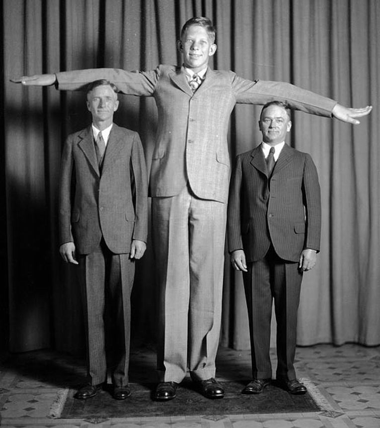 Самый Длинный Человек В Мире Фото